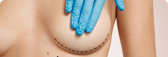 breast-surgery